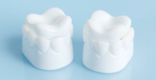 Зубные коронки E-max: Почему они становятся выбором номер один!